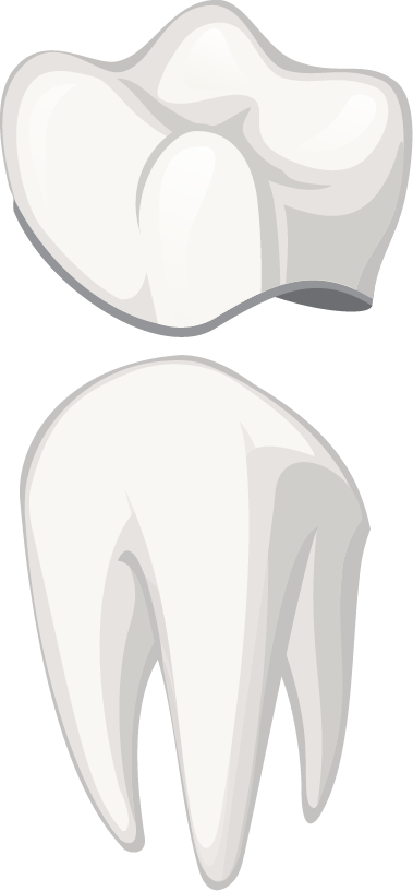 dente corona illustr